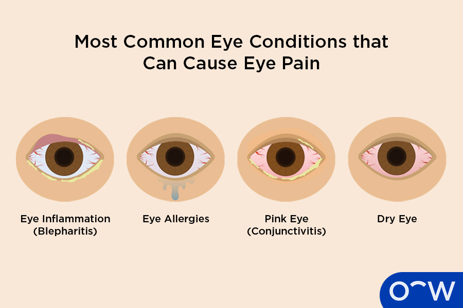 Waking Up With Morning Eye Pain? Causes & Relief
