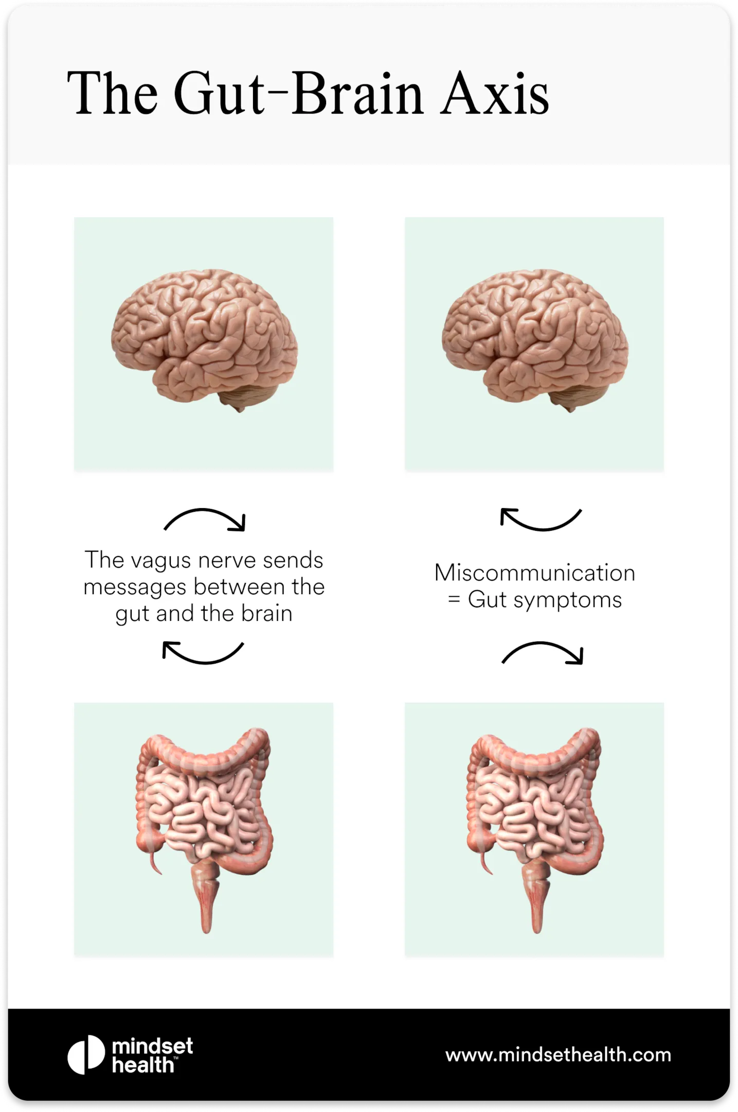 IBS and Anxiety: Science of the Gut-Brain Link