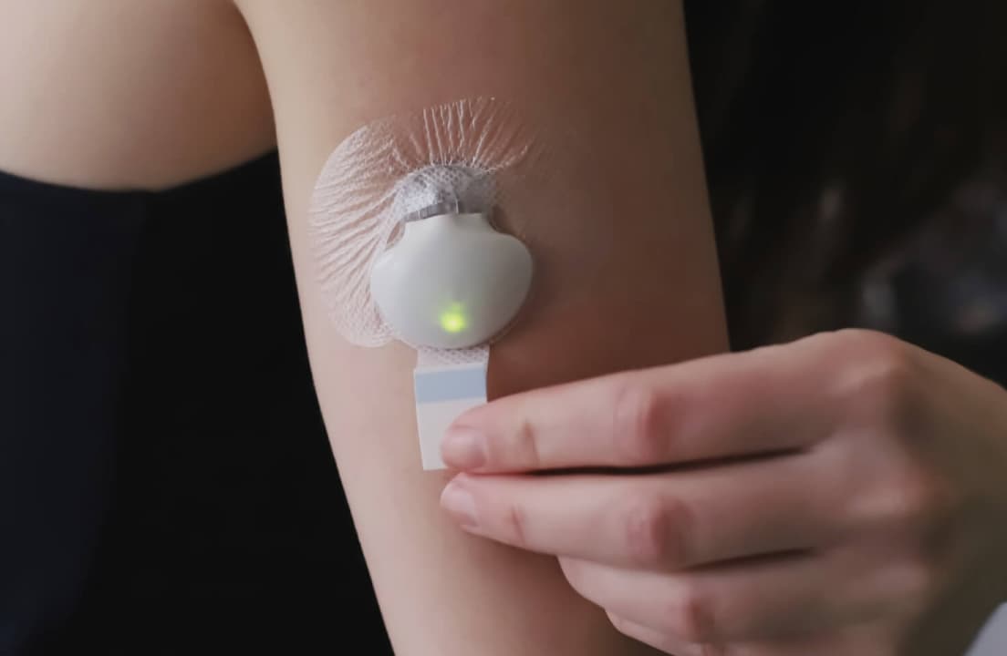 The MiniMed Guardian 4 glucose sensor and its integration with medical delivery systems.
