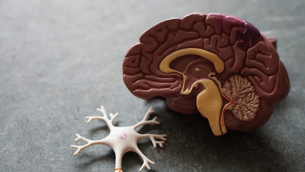 An anatomical model of the human heart showing the complex network of coronary arteries.