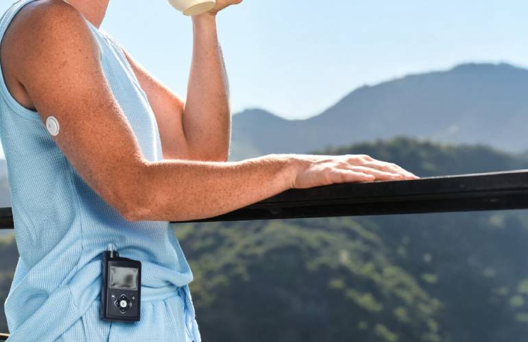 A CGM sensor applied discreetly to the back of a person's upper arm.