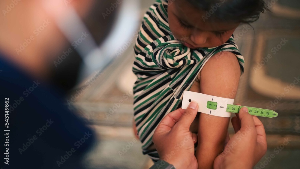 Type 5 Diabetes: Malnutrition and GLP-1 Explained
